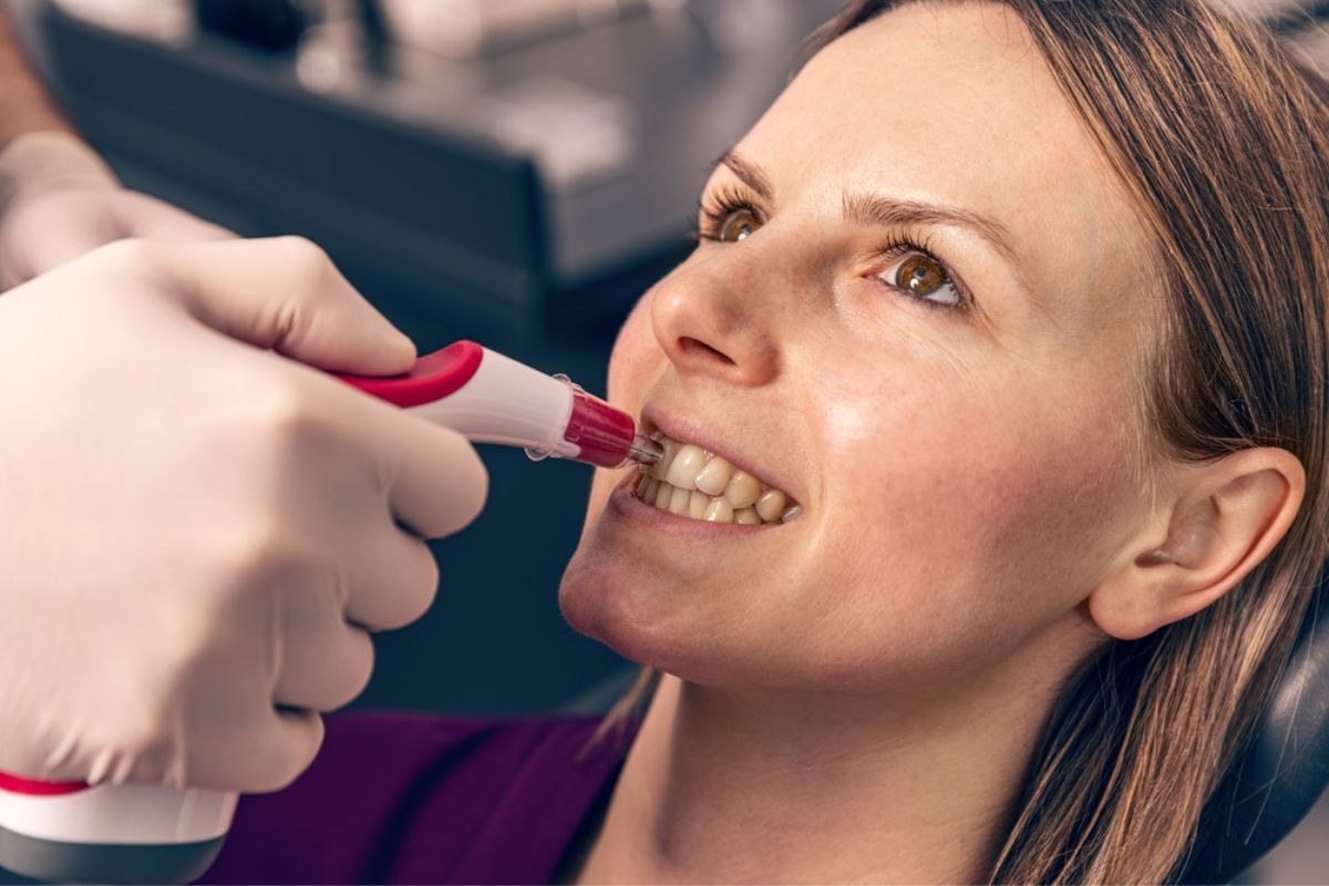 Best Teeth Whitening for Sensitive Teeth