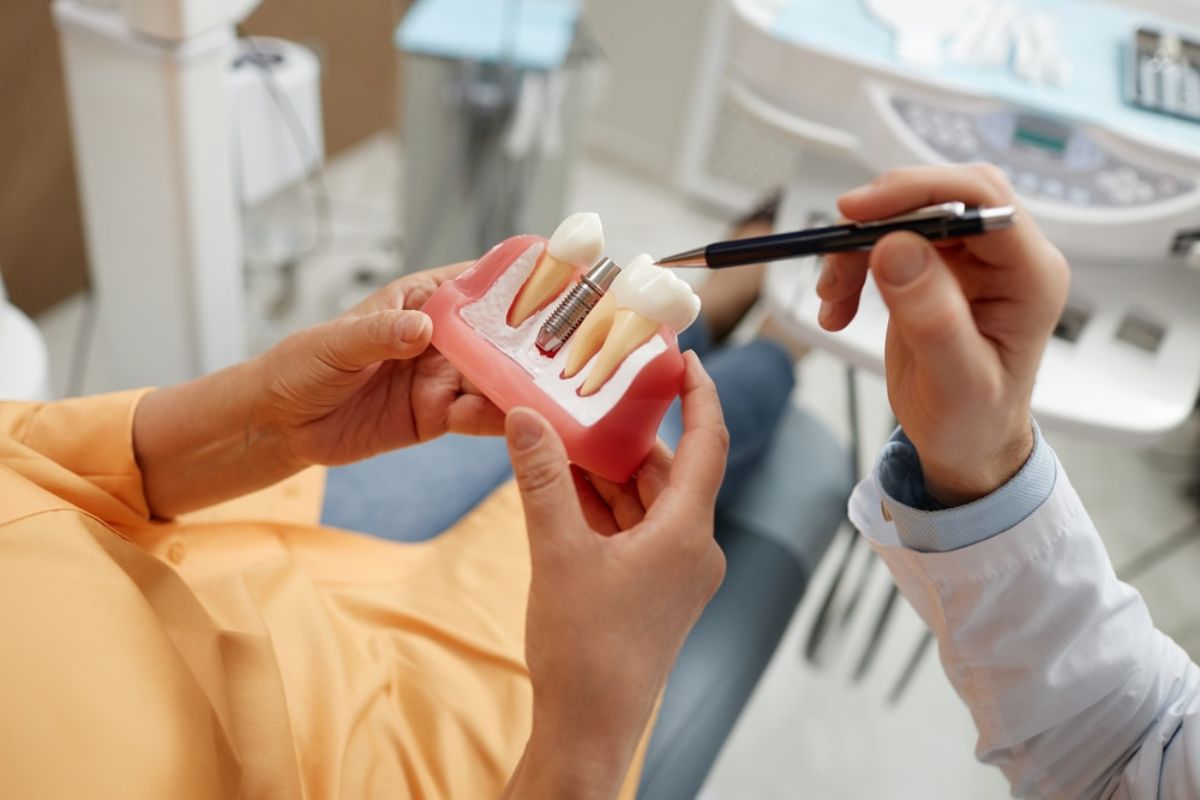 Top Benefits of Dental Implants
