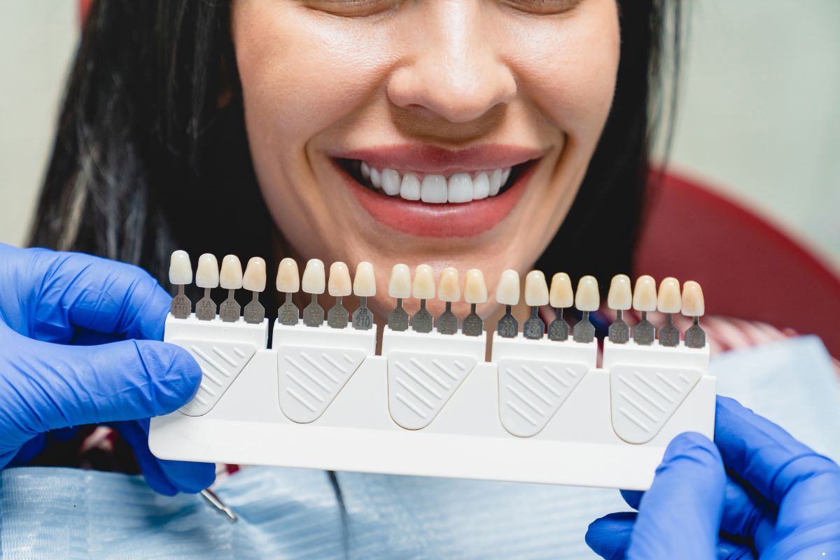 How Dental Veneers Are Made for a Natural Look