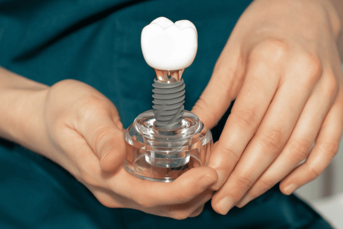 dental implants Oxford