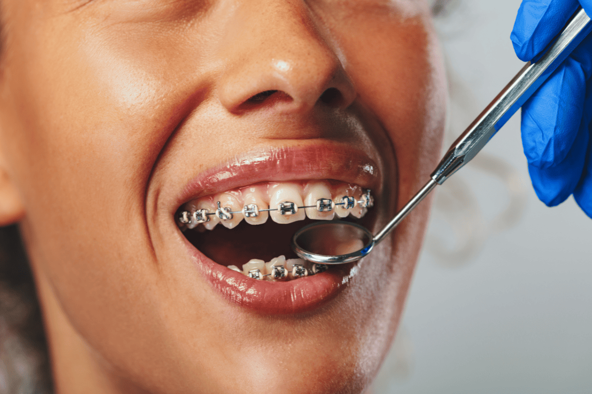 cosmetic dentist Oxford