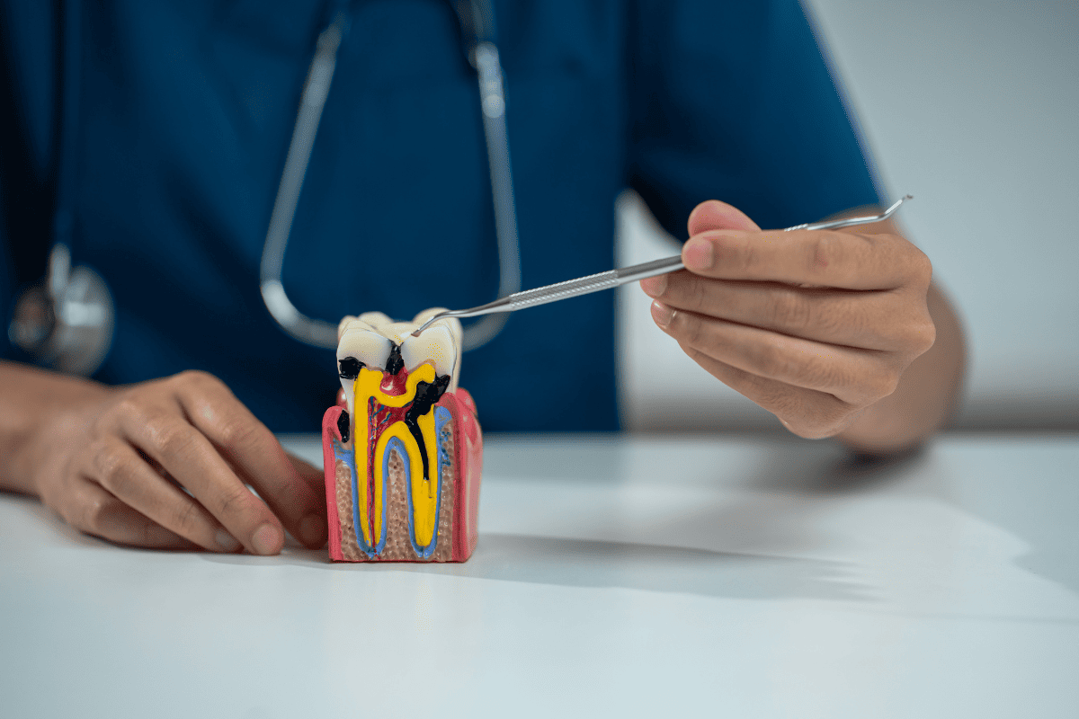 dental implants in Oxford
