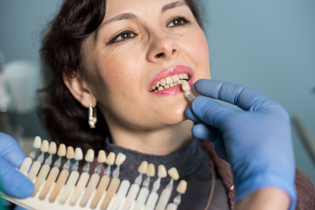 veneers in Oxford