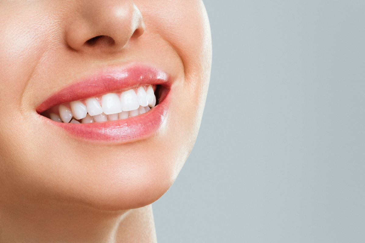 Teeth Whitening Oxford
