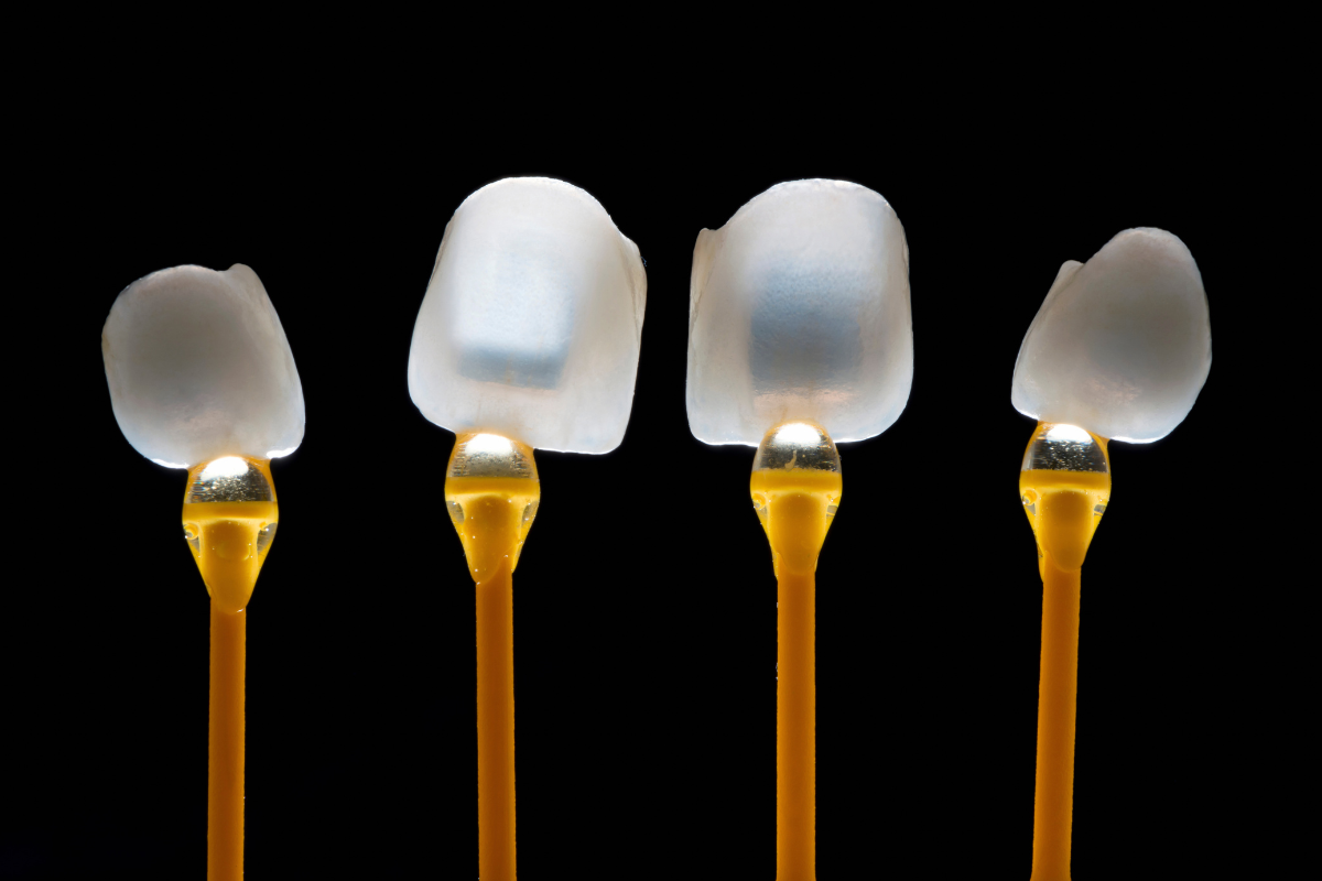 veneers in Oxford